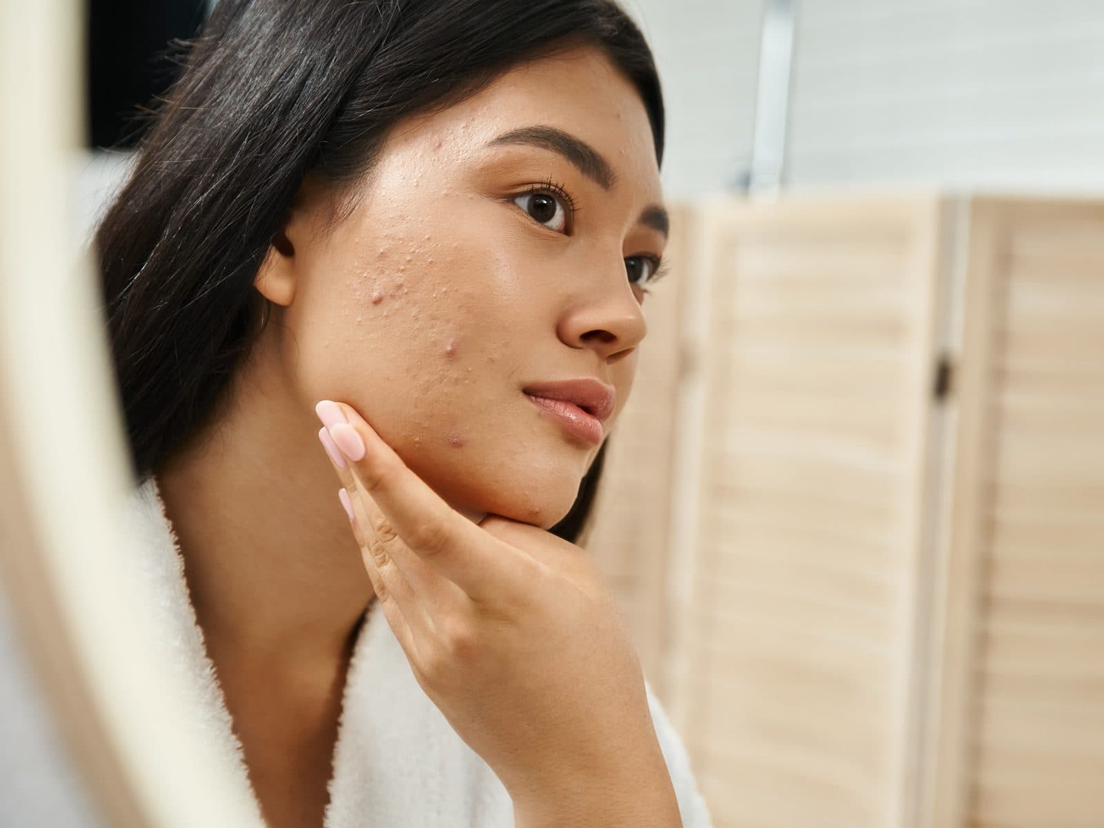 Jovem observa no espelho a pele do rosto com acne ativa